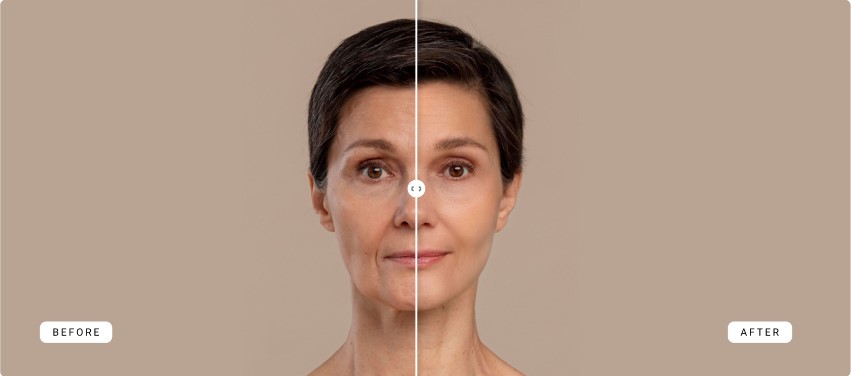 before-after-results-1